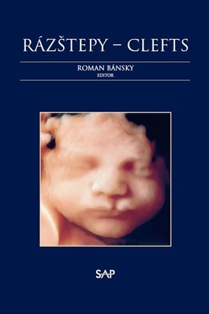 Kniha Rázštepy - Clefts - Roman Bánsky