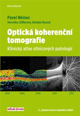 Optická koherenční tomografie