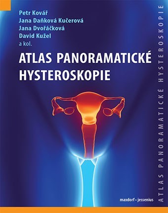 Kniha Atlas panoramatické hysteroskopie