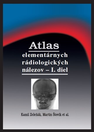Atlas elementárnych rádiologických nálezov - I. diel