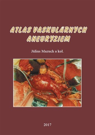 Kniha Atlas vaskulárnych aneuryziem - Július Mazúch
