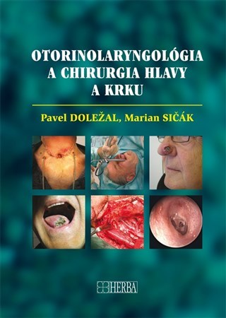 Kniha Otorinolaryngológia a chirurgia hlavy a krku - Pavel Doležal,Marián Sičák