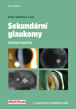 Sekundární glaukomy - Kolektív autorov