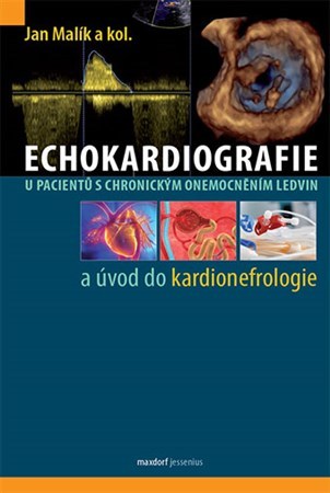 Echokardiografie u pacientů s chronickým onemocněním ledvin a úvod do kardionefrologie - Kolektív autorov,Jan Malík