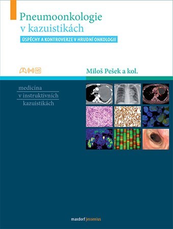 Pneumoonkologie v kazuistikách - Kolektív autorov,Miloš Pešek