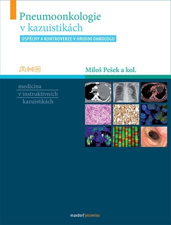 Kniha Pneumoonkologie v kazuistikách