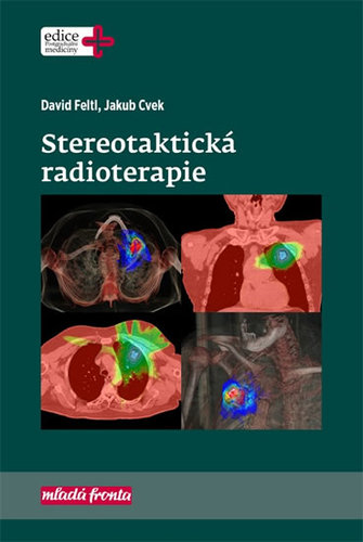 Stereotaktická radioterapie - Feltl David,Jakub Cvek