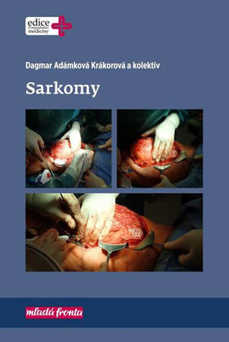 Sarkomy - Dagmar Adámková Krákorová,Kolektív autorov