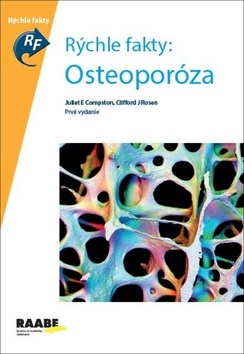 Kniha Rýchle fakty: Osteoporóza