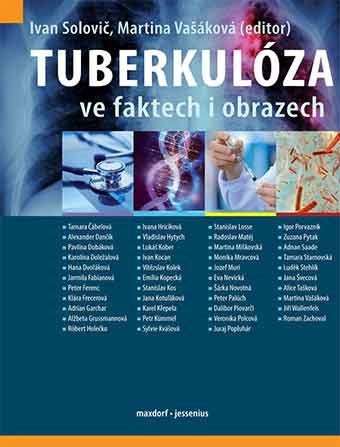 Tuberkulóza ve faktech i obrazech - Ivan Solovič,Martina Vašáková
