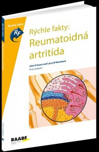Kniha Rýchle fakty: Reumatoidná ARTRITÍDA