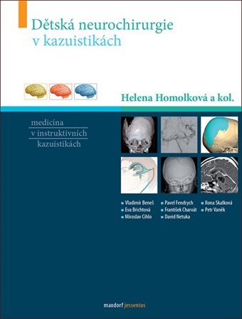 Kniha Dětská neurochirurgie v kazuistikách
