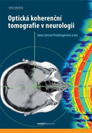 Optická koherenční tomografie v neurologii - Kolektív autorov,Jana Lízrová Preiningerová