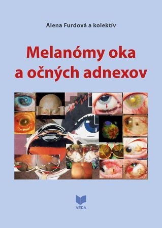 Kniha Melanómy oka a očných adnexov - Kolektív autorov,Alena Furdová