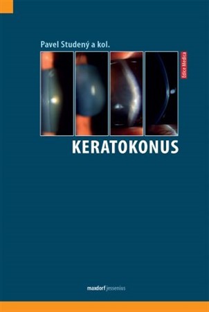 Kniha Keratokonus