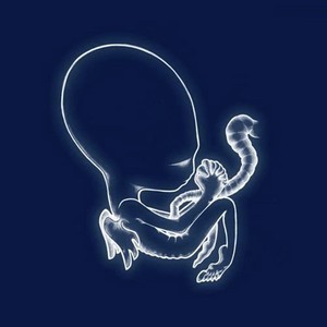 Sigur Rós - Ágaetis Byrjun 2LP