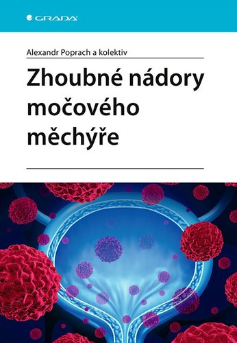 Zhoubné nádory močového měchýře kúpite na Panta Rhei