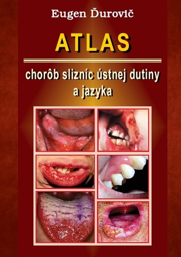 Atlas chorôb slizníc ústnej dutiny a jazyka - Eugen Ďurovič