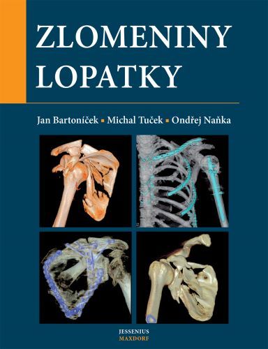 Zlomeniny lopatky - Jan Bartoníček,Michal Tuček,Ondřej Naňka