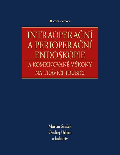 Intraoperační a perioperační endoskopie a kombinované výkony na trávicí trubici - Kolektív autorov