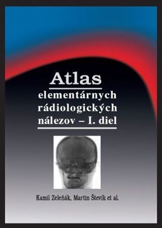 Atlas elementárnych rádiologických nálezov - I. diel - Kamil Zeleňák,Martin Števík