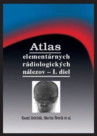 Kniha Atlas elementárnych rádiologických nálezov - I. diel - Kamil Zeleňák,Martin Števík