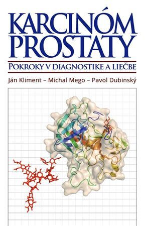 Karcinóm prostaty - Ján Kliment,Michal Mego,Pavol Dubinský