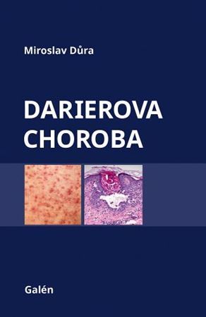 Kniha Darierova choroba