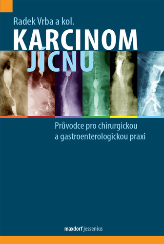 Kniha Karcinom jícnu - Průvodce pro chirurgickou a gastroenterologickou praxi