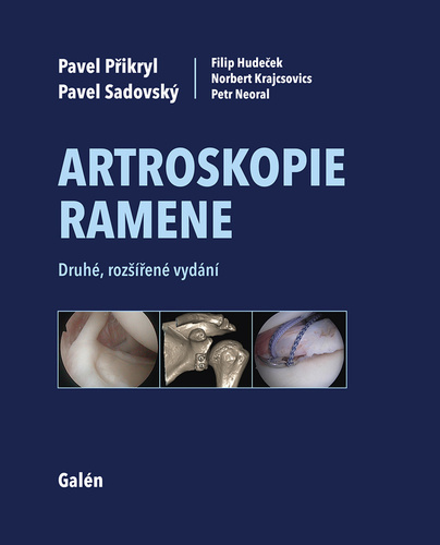 Artroskopie ramene, 2. vydání - Pavel Přikryl,Pavel Sadovský,Kolektív autorov