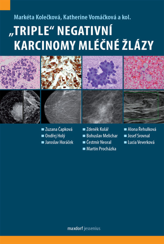 „Triple“ negativní karcinomy mléčné žlázy - Kolektív autorov