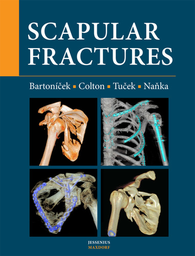 Kniha Scapular fractures