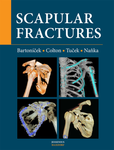 Scapular fractures - Kolektív autorov