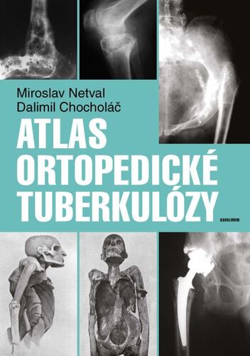 Kniha Atlas ortopedické tuberkulózy - Dalimil Chocholac,Miroslav Netval
