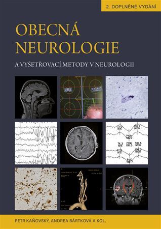 Obecná neurologie a vyšetřovací metody v neurologii - Andrea Bártková,Kolektív autorov,Petr Kaňovský