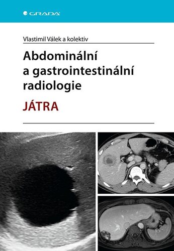 Abdominální a gastrointestinální radiologie kúpite na Panta Rhei