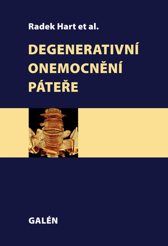 Kniha Degenerativní onemocnění páteře - Radek Hart a kolektív