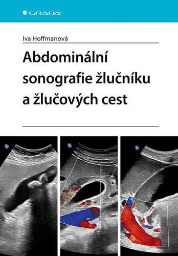 Kniha Abdominální sonografie žlučníku a žlučových cest