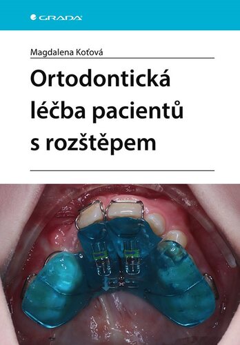 Ortodontická léčba pacientů s rozštěpem kúpite na Panta Rhei