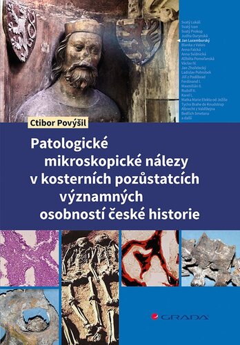 Patologické mikroskopické nálezy v kosterních pozůstatcích významných osobností české historie kúpite na Panta Rhei