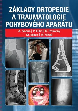 Základy ortopedie a traumatologie pohybového aparátu - Kolektív autorov