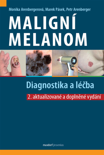 Maligní melanom: Diagnostika a léčba, 2. vydání