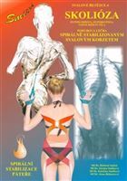 Svalové řetězce 4: Spirální stabilizace páteře - Skolióza