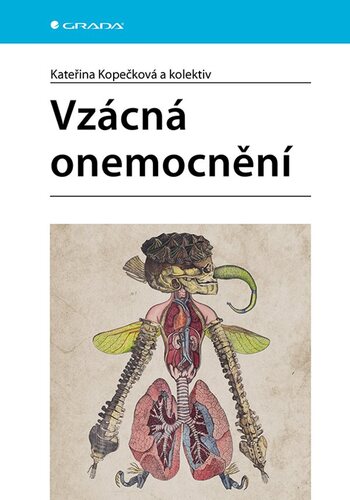 Vzácná onemocnění