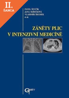 Lacná kniha Záněty plic v intenzivní medicíně
