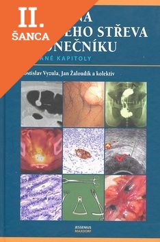 Lacná kniha Rakovina tlustého střeva a konečníku