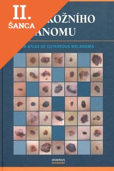 Lacná kniha Atlas kožního melanomu