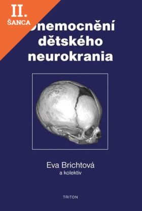Lacná kniha Onemocnění dětského neurokrania