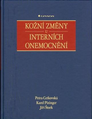 Kožní změny u interních onemocnění