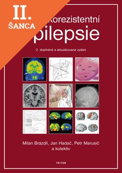 Lacná kniha Farmakorezistentní epilepsie